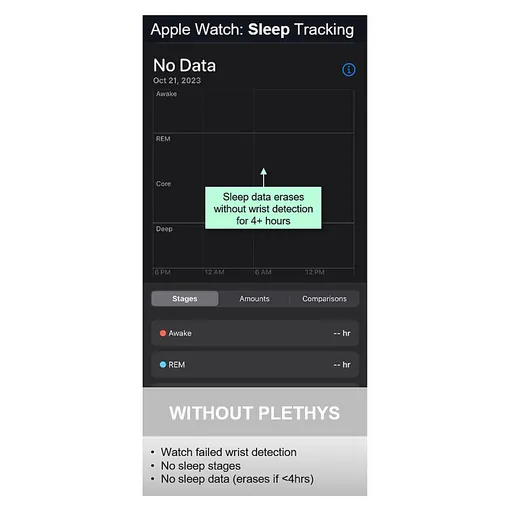 Apple watch results and failures from not using the Plethys product