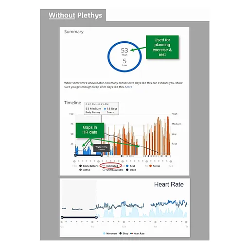 Garmin watch results and failures from not using the Plethys product